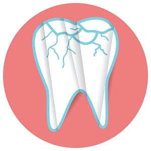 home treatment for broken tooth