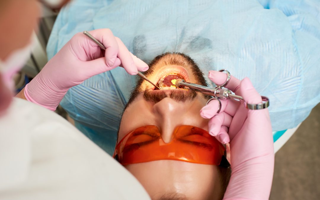 Root Canal Infections: Everything You Should Know