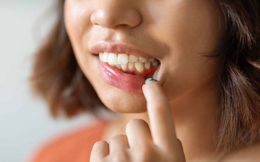 Beyond the Brush: Why Do I Have Puffy Gums and What Is My Mouth Telling Me?